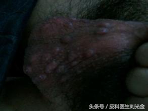 揭开谣言背后的真相,揭开麻风病村的神秘面纱