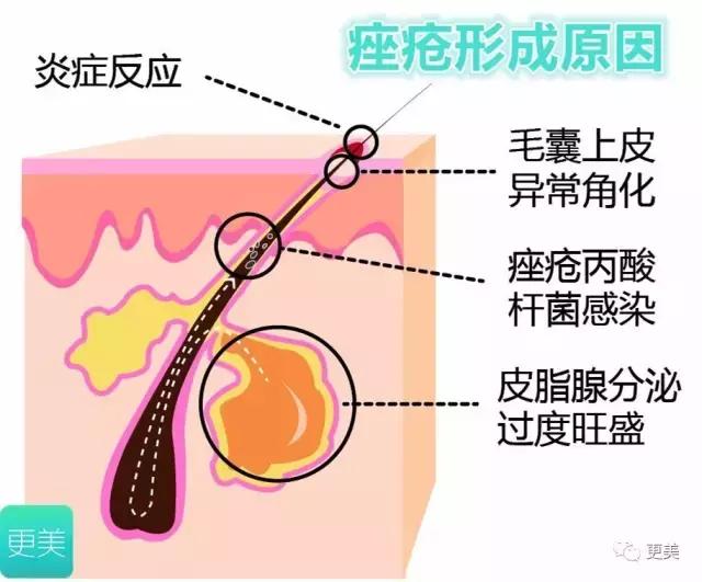 不吃辣不熬夜不生气,不吃辣不熬夜皮肤就是毛孔大