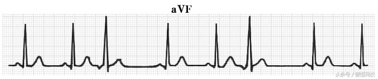 郭雅卿心电图讲解全集,郭雅卿血汗管视频课