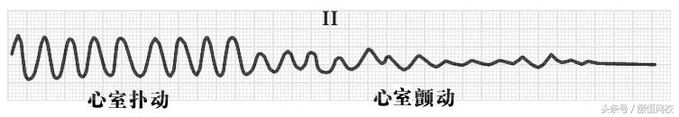 郭雅卿心电图讲解全集,郭雅卿血汗管视频课