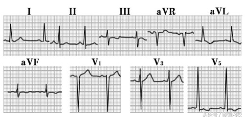 郭雅卿心电图讲解全集,郭雅卿血汗管视频课