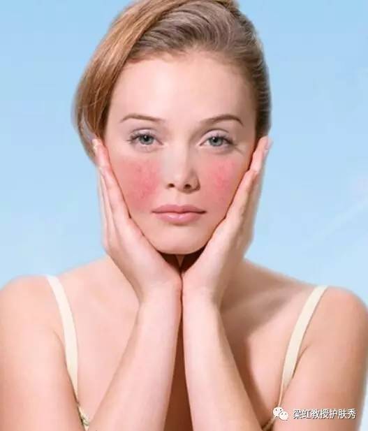 （梁虹护肤）你使用过含激素的护肤品吗？