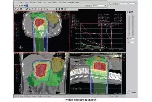 中国的质子中心有几家,全国有几所质子医院哪所最好