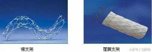 微创介入科一卫毅楠,什么是血汗管介入治疗