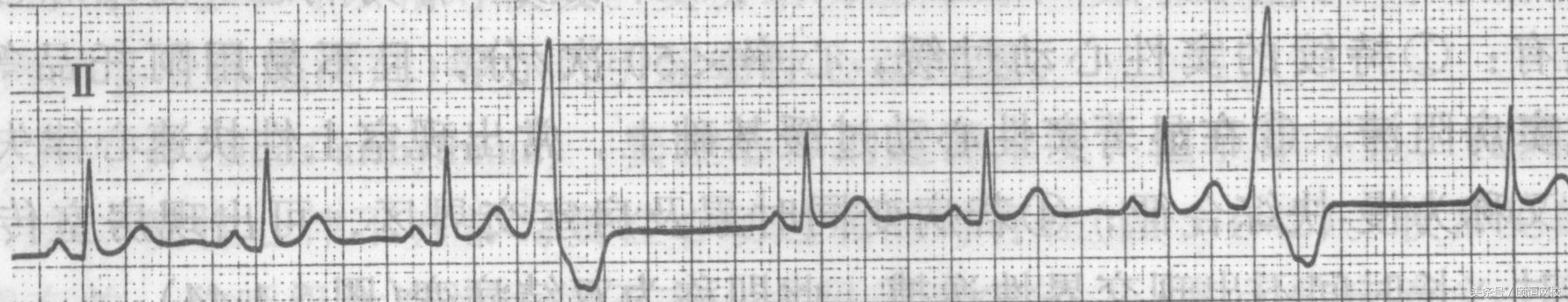 郭雅卿心电图讲解全集,郭雅卿血汗管视频课