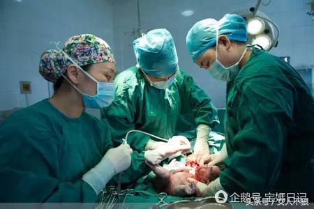 产房老公拒绝让我无痛分娩,生孩子顺产难产老公不让剖腹