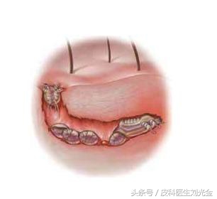 揭开谣言背后的真相,揭开麻风病村的神秘面纱