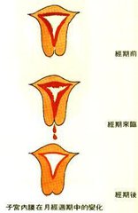 月经总是推迟会多囊吗,月经总推迟2天正常吗