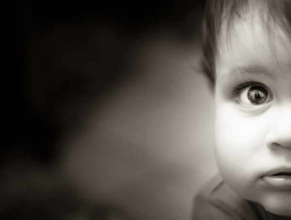 宝宝脸上有咖啡斑多大可以做激光,5个月宝宝脸部做激光