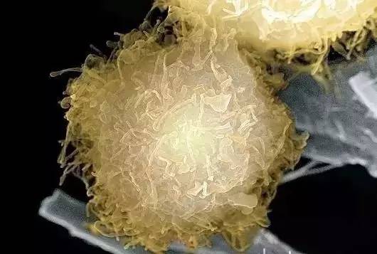 Word天！想不到癌细胞如此惊艳