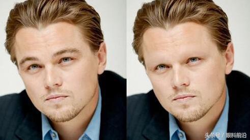 眉毛能拔下来是有病吗,眉毛可以揪掉吗