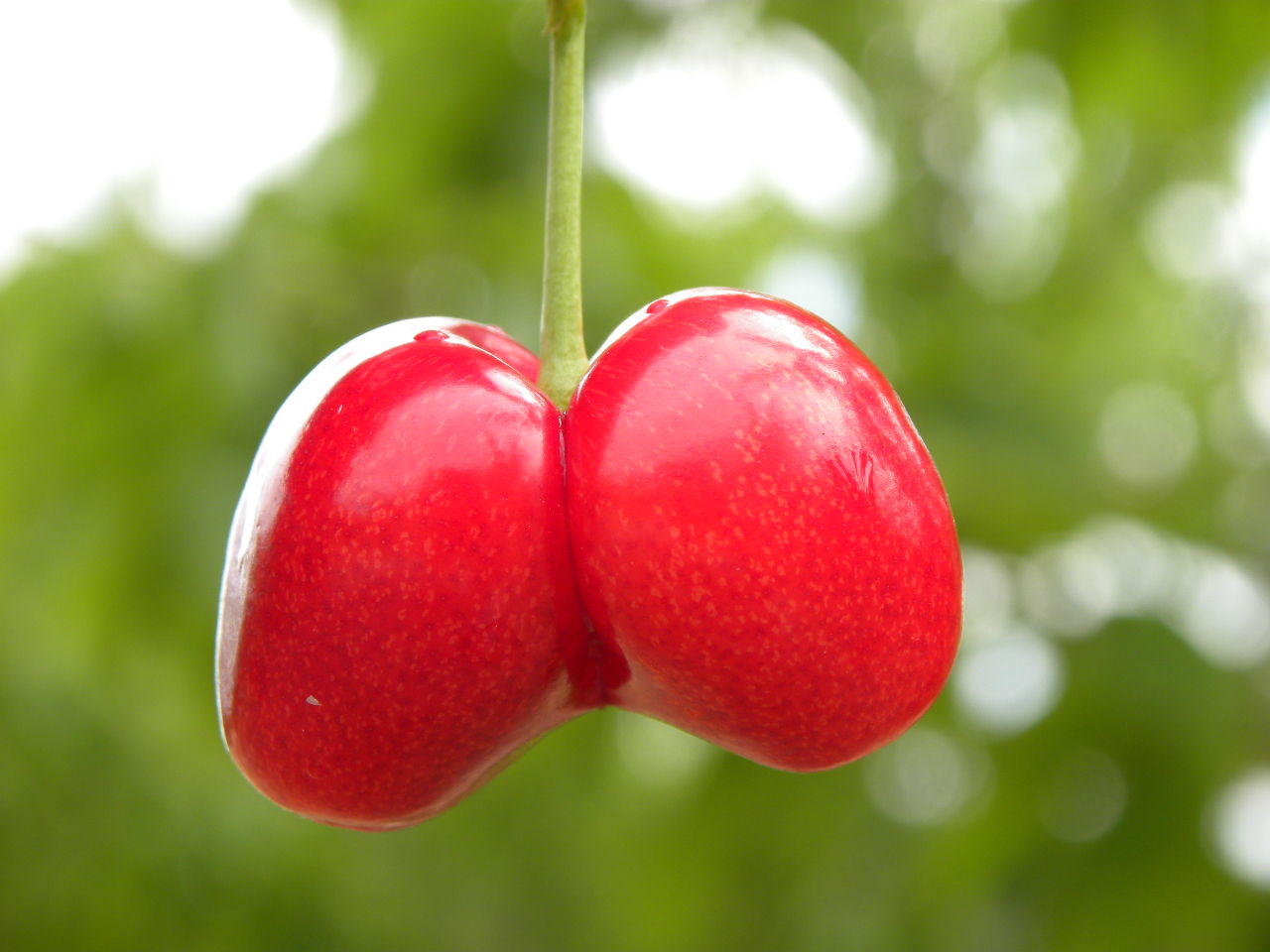 局灶增生性iga肾病饮食,局灶性iga肾病