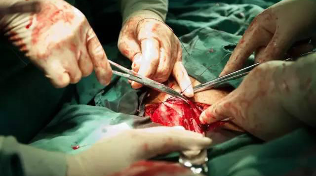 剖腹产后悔是怎么回事,有顺产的机会剖腹产了会后悔吗