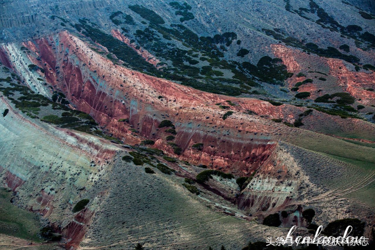 尖锐性湿疣怎么避免复发,尖锐性湿疣如果复发怎么办