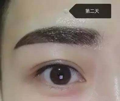 纹眉后恢复过程不要惊慌,男士纹眉恢复全过程图片