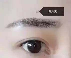 纹眉后恢复过程不要惊慌,男士纹眉恢复全过程图片