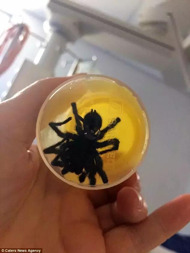 澳洲大蜘蛛咬人死亡,澳大利亚被蜘蛛咬死