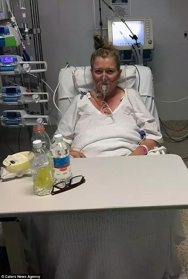 澳洲大蜘蛛咬人死亡,澳大利亚被蜘蛛咬死