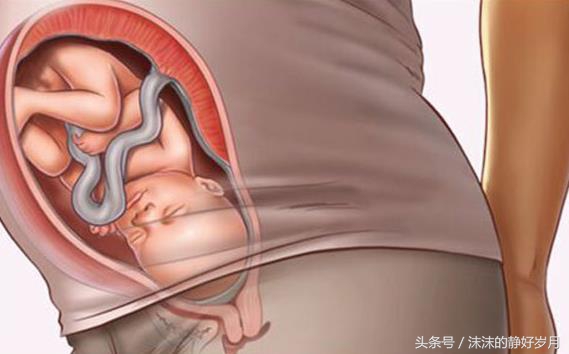28周入盆后关注事项,孕妇三十七周已经入盆