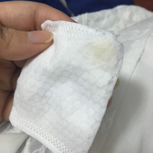 简单又有效的祛黑头方法，今天才是实在的方法