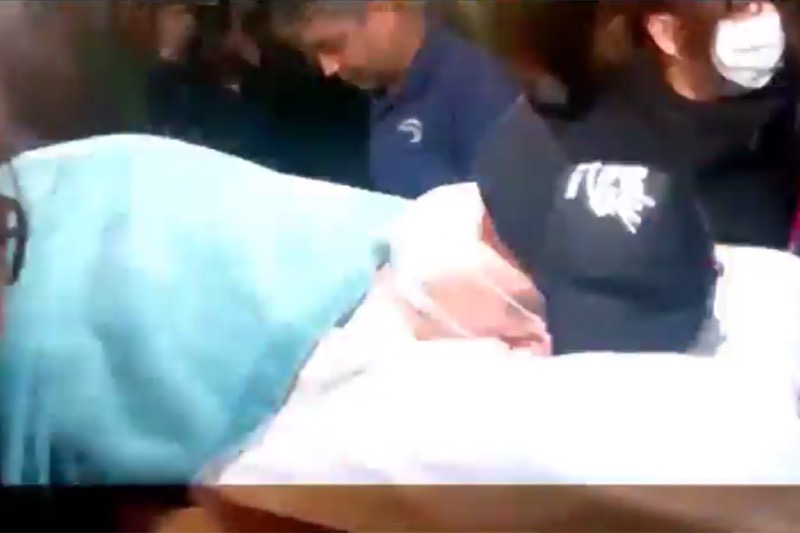 刘德华坠马前后,刘德华坠马是开刀还是保守治疗