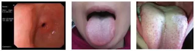 舌苔辨证图谱望舌识病,揭秘舌苔图谱轻松自诊