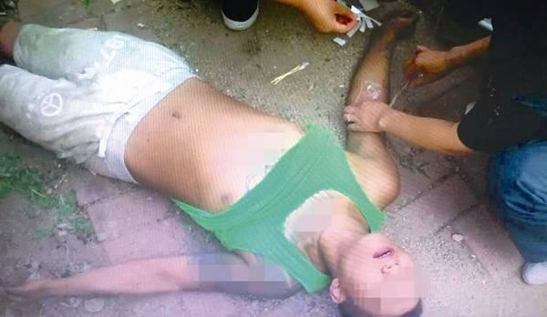 吸食过毒脑子有什么变化,吸食有毒气体后怎么办