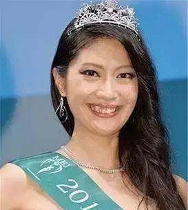 牙齿不齐凹进去,牙齿不齐有的地方刷不掉