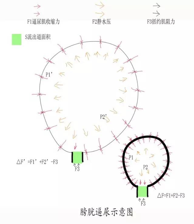 关于妇科手术病人拔尿管前定时夹闭尿管训练逼尿肌功能的逻辑反驳