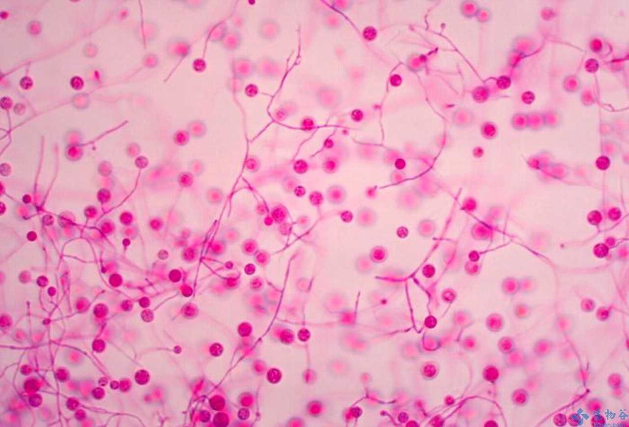 真菌过敏止痒,真菌是越热越痒吗