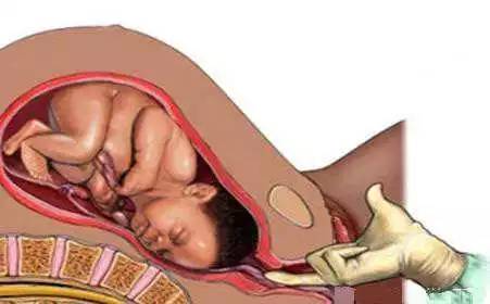 「科普」剖腹产的女明星那么多，为啥瘦小的“教主夫人”（杨颖）却能顺产？