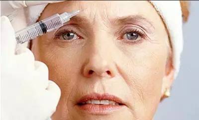 您了解脸上的皱纹吗？