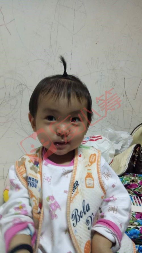 小儿粒细胞减少骨髓移植,宝宝粒细胞缺乏要做骨髓穿刺吗