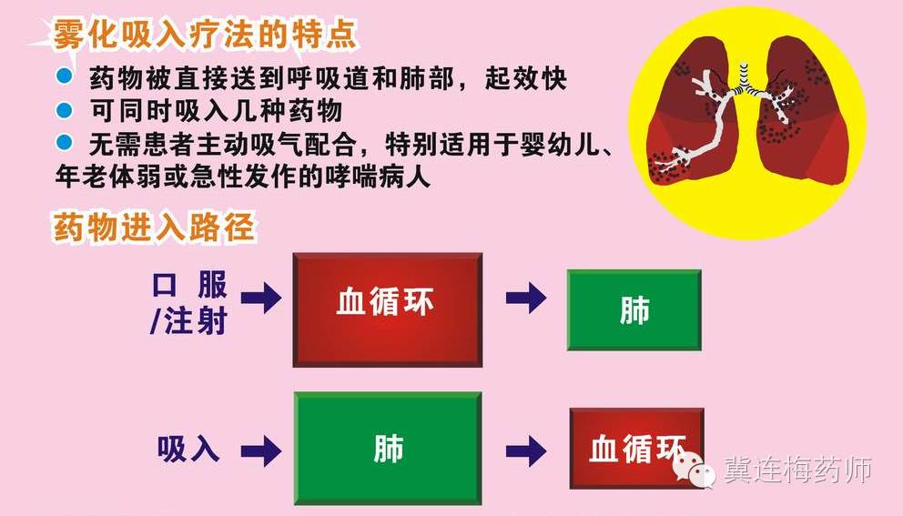 儿童雾化吸入专家共识,雾化吸入用药共识冀连梅