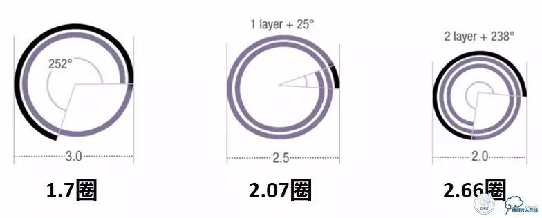 CINS2016病例展｜一例双侧大脑前动脉栓塞的再通治疗
