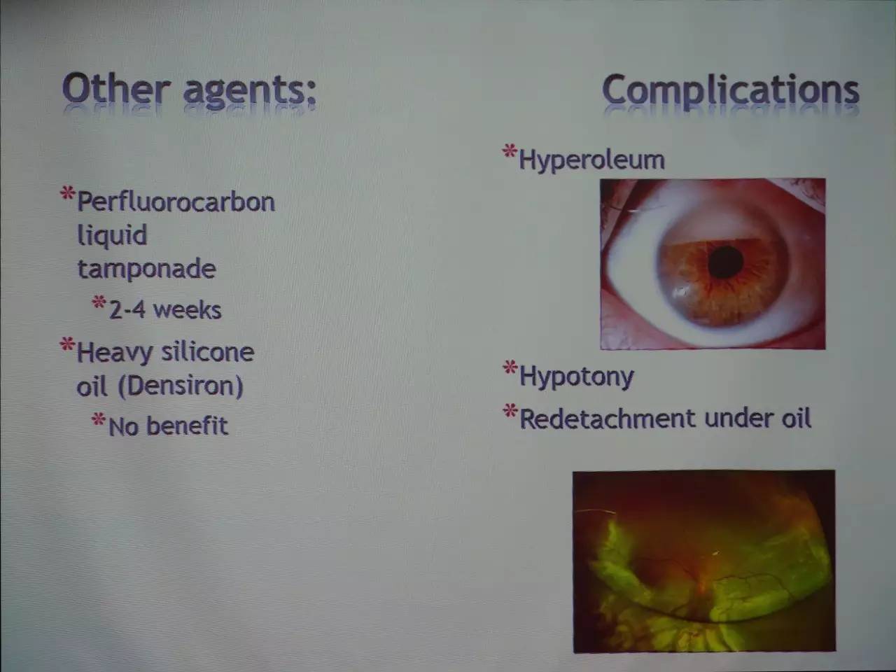 pvr眼科上是什么意思,pvr在眼底是什么病