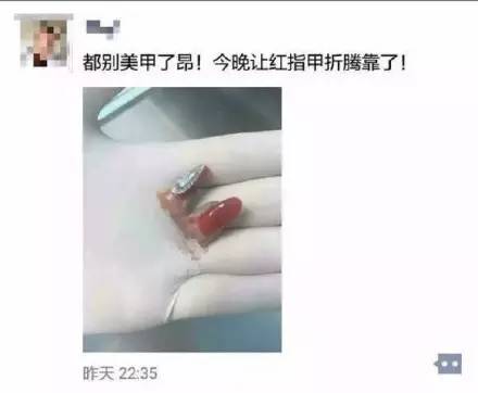 老师给幼儿剪指甲不谨慎剪到手,幼儿园小孩被老师剪指甲流血