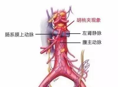 胡桃夹子魔境冒险,胡桃夹子芭蕾舞剧