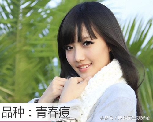 30几岁各种长痘,30多了还在长痘