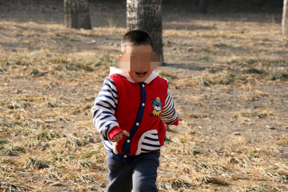 孩子睫毛被烧了能长出来吗,儿童睫毛被火烧了眼睛会流眼泪吗