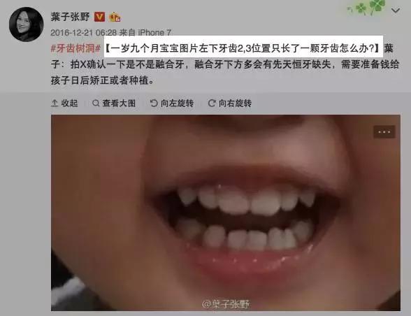 儿童少一颗乳牙会有影响吗,孩子少长一颗牙怎么回事