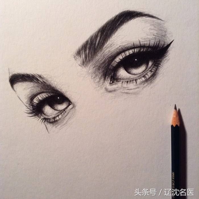 追剧、戴美瞳，女孩上眼皮长满“结石”，医生一针针刺破救眼睛