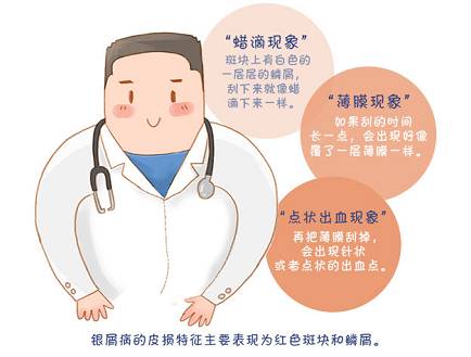 周主任讲解银屑病,银屑病健康宣教计划