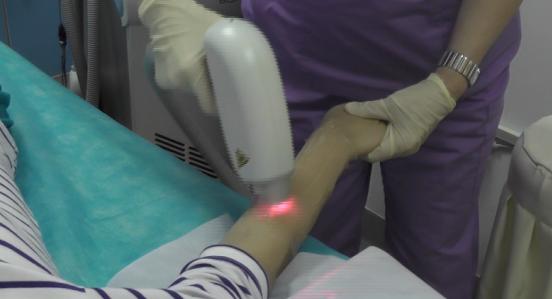 激光脱毛要脱几次才干净,激光脱毛脱唇毛几次脱干净