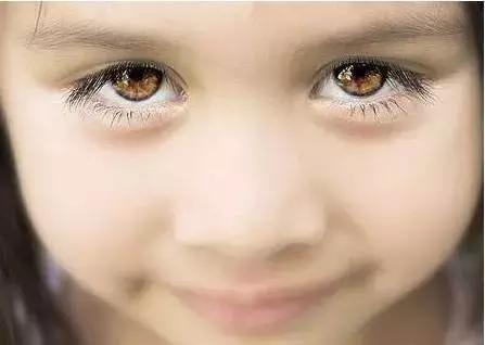 医生四条建议家有近视娃必看,适合小孩看的近视科普