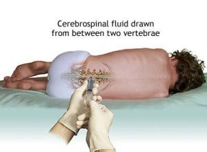 腰椎穿刺术操作流程完成时间,腰椎穿刺术操作考核评分标准