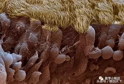 鼻窦炎图片和治疗方法,副鼻窦炎最好的治疗方法