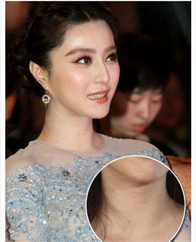 黄金微针祛除颈纹,去除颈纹的微针视频