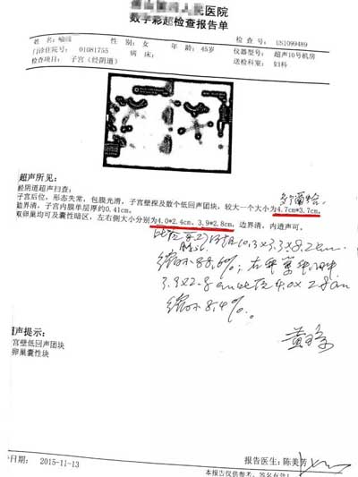 双侧卵巢囊肿剥离术后6年又复发，保守治疗后左侧缩小88.6%