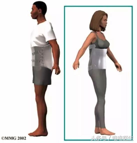 腰椎管狭窄保守治疗怎么治疗,老年腰椎管狭窄的保守治疗法